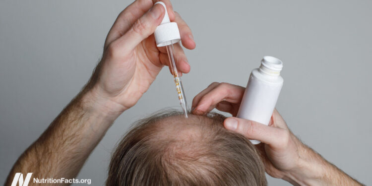 The Benefits and Risks of Hair Loss Drugs